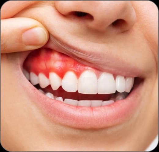 Periodontoloji